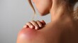 © EarthWalker - Woman's shoulder with red irritated skin from allergy or inflammation. Medical hospital pain treatment concept