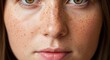 © Erisna Yolanda - Close-up of a young person's face, displaying many freckles across the nose and cheeks, with prominent green eyes