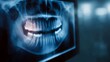 © Bussakon - Digital panoramic dental X ray on a screen highlighting a problematic tooth and jawbone for diagnosis
