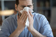 © fizkes - Closeup portrait sick man covering nose mouth with paper napkin