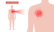 © pikovit - Dermatitis skin disease