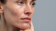 © LimeSky - A woman with acne on a gray backdrop shown without makeup