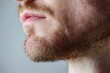 © Dhoku  Studio - Close-up profile view of a man's face and beard with noticeable skin imperfection.