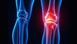 © Graphinix - Knee pain relief concept with glowing red inflammation, ideal for medical research or healthcare marketing focused on joint health and treatment options