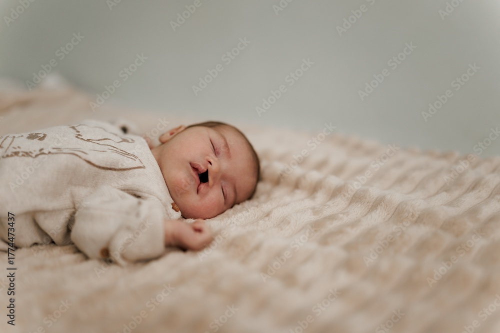 A sleeping newborn baby with congenital defect of cleft lip and palate ...