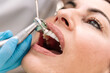 © Renata Hamuda - Close up of Dentist polishing teeth of female patient in dental clinic