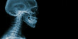 © Mind - Skull xray lateral view, human head profile, cervical spine, medical diagnostic