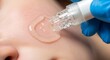 © Olesya - Woman receiving facial treatment with microneedling device for skin rejuvenation. Cosmetology procedure for aesthetic beauty and anti-aging.
