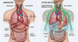 © THIBNH - Illustration of vagus nerve activation showing before fightflight and after restdigest states 34989736 1