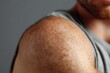 © Olena - Close-Up of a Young Man's Arm with Keratosis Pilaris: Insight into Treatment and Skin Care for Healthier Skin