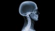 © Bussakon - X ray image showing the profile view of a human skull and cervical spine