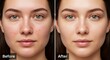 © YUSUF - Experience the remarkable visual evolution of a woman's skin, transitioning from minor imperfections to a flawlessly clear and beautifully enhanced facial appearance