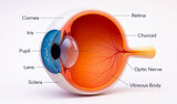 Diabetic retinopathy, eye, medical illustration with symbols