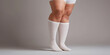 © sam richter - woman legs with lip edema and compression socks