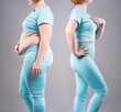 © staras - Before and after weight loss transformation, woman’s fat body showing slimming results, liposuction, plastic surgery and tummy tuck concept