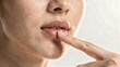 © AFFANYUDA - Close-up of a person touching dry, chapped lips with a finger