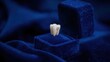© Никита Цыганков - White healthy tooth with diamond gem inside a blue velvet ring box. Concept of expensive dentistry, implants, health insurance and precious smile.