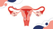 © Biz Flare - Medical illustration of the female reproductive system showing conditions like endometriosis or uterine fibroids affecting the uterus.