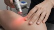 © Gambles - Laser Therapy on Knee for Pain Relief and Healing.