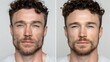 © rinrada - before-after men daily shaving skin recovery, irritated damaged skin vs healthy restored ski