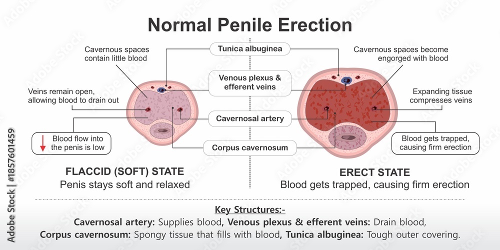 Normal Penile Erection- Flaccid vs Erect State Stock Illustration ...