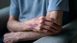 © Moddy - Aged Hand with Bruise: An intimate view of a senior's hand resting on a surface, revealing a bruise that tells a story of life's experiences, challenges, and resilience.