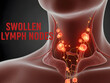 © Sharmin - Swollen lymph nodes in human body