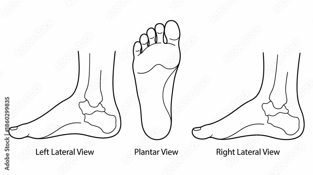 Foot View Human Foot Anatomy Vector – Left Lateral, Plantar, Right Medial Views ...