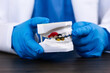© Tom - Dental surgeon analyzes study model plaster cast of upper and lower jaw, planning oral surgery, diagnosis of mandibular pathology, surgical treatment, clinical dental precision technique
