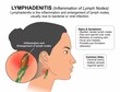 © KAMAKSI - Lymphadenitis (Inflammation of Lymph Nodes)