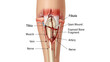 © Lokman - human leg anatomy with labeled parts and open wound