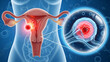 © FestiveFrame Studio  - Uterus cancer medical illustration showing tumor inside female reproductive organ with cells and tissue for healthcare diagnosis treatment research and modern clinical science