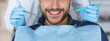 © Prostock-studio - Cropped of smiling bearded man and dentist hands in blue robber gloves with dental tools, panorama. Unrecognizable male patient visiting dentistry, having regular checkup, closeup, web-banner