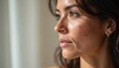 © Pete - Close-up profile Hispanic woman with natural skin texture. Shows hyperpigmentation, dark patches, uneven tone, and sun spots. Focus on realistic female beauty and skin conditions.