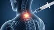 © designhunt - Cervical spine injection and neck pain treatment. Pain management and spinal therapy. Medical syringe needle entering the vertebrae to deliver medication for nerve relief
