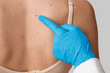 © Pixel-Shot - Dermatologist examining young woman with moles on pink background, closeup