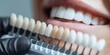 © SKV - The teeth with a dental shade guide during a cosmetic teeth whitening consultation