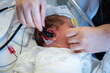 © batuhan toker - Newborn baby receiving a hearing screening test by medical professional in a hospital, assessing infant auditory health and developmental well-being at early age
