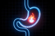 © ATIKUL - Burning stomach illustrated with neon and light showing painful digestive discomfort condition problem and illness