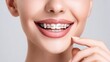 © mila103 - A young woman with straight hair is smiling confidently while showing her braces. She is indoors, highlighting her vibrant personality and dental transformation.