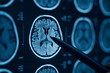 © Elena - Close-up of a pen pointing at a detailed MRI scan of a human brain on a digital screen