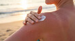 © Tatiana - Close-up of a hand applying white after-sun balm on a sunburned shoulder with peeling skin texture at the beach during summer