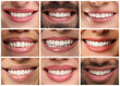 © New Africa - Smiling men and women, collage of closeup photos