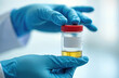 © Pete - Hands in blue gloves hold vial with urine sample for drug testing in lab. Specimen container with yellow liquid for analysis. Health care checkup.