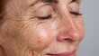 © Newleks - Middle aged woman's profile face featuring closed eyes, visible fine lines, wrinkles, crow's feet, pigment spots, and freckles, illustrating skin aging and texture