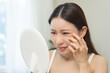 © KMPZZZ - Anti aging, worry puberty asian young woman, stressed girl looking in mirror, allergy presenting an allergic reaction from cosmetic on face. Beauty, health care from acne problem, dry skin, treatment.