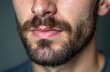 © Vadym - Man with patchy beard, visible stubble and mustache. Male face with sparse facial hair growth, light skin with freckles, showing a hair problem.