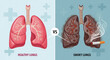 © Faadi - Healthy lungs vs smoky lungs comparison of healthy and damaged lungs from smoking