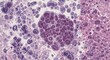 © AkuAku - Histological image of liver hepatocytes stained H and E featuring enlarged nuclei with polyploidy in multiples of chromosomal sets