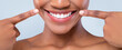 © Prostock-studio - A woman is showing her bright smile while pointing at her teeth with her fingers. She is indoors against a light background. Her joy and positivity are clear in her expression.